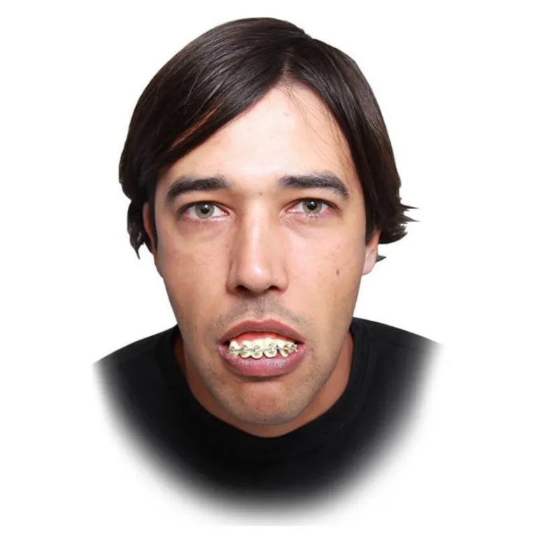 Dentadura con Brakets
