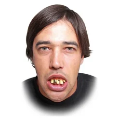 Dentadura con diente de oro